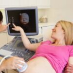 4D ultrazvuk i DVD snimka bebe uz uključen anomaly scan