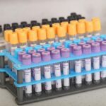 Laboratorijska analiza hormona štitnjače T3, T4, TSH