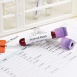 Kompletne pretrage iz krvi i urina + testiranje hormona štitnjače (T3,T4,TSH)